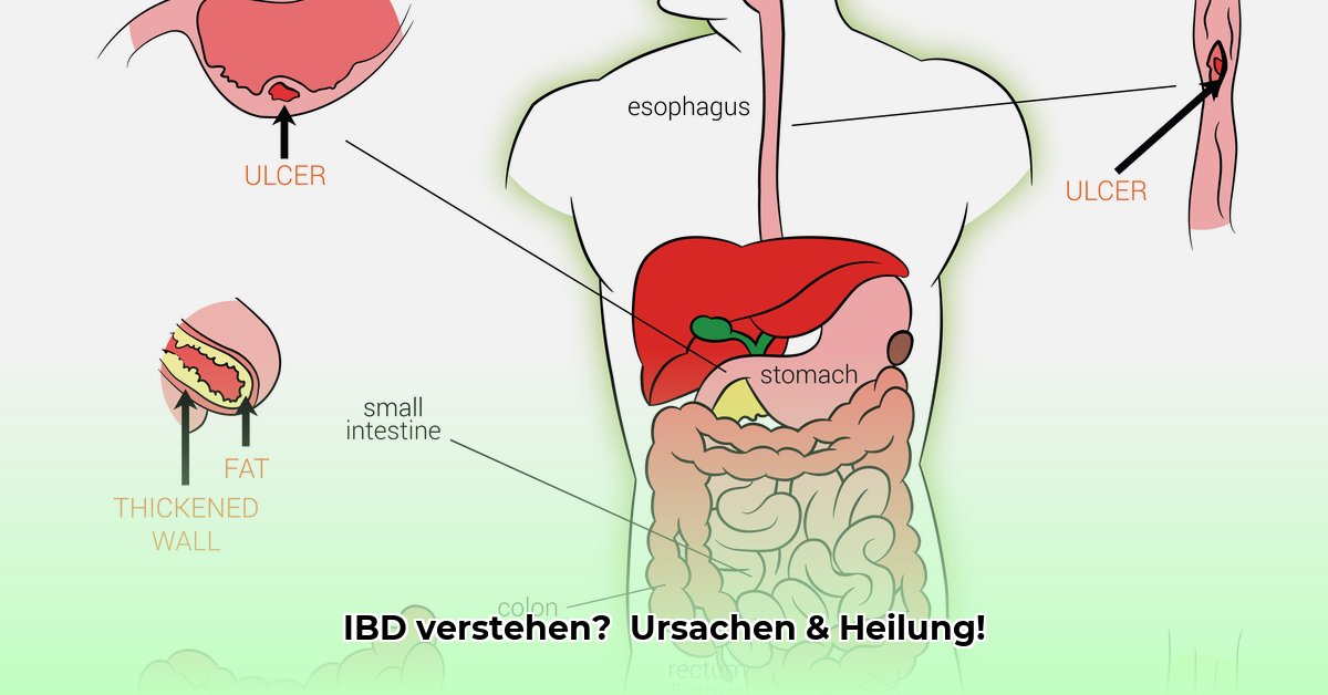 ibd-ziekte